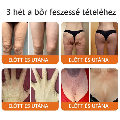 🔥 ZödVita® Méhméreg Bőr Helyreállító Krém 🔥 Magyar fejlesztés, magyarországi gyártás és szállítás