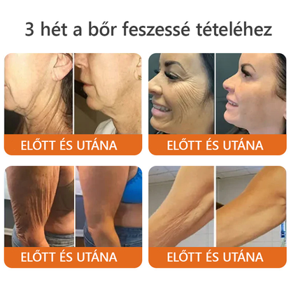 🔥 ZödVita® Méhméreg Bőr Helyreállító Krém 🔥 Magyar fejlesztés, magyarországi gyártás és szállítás