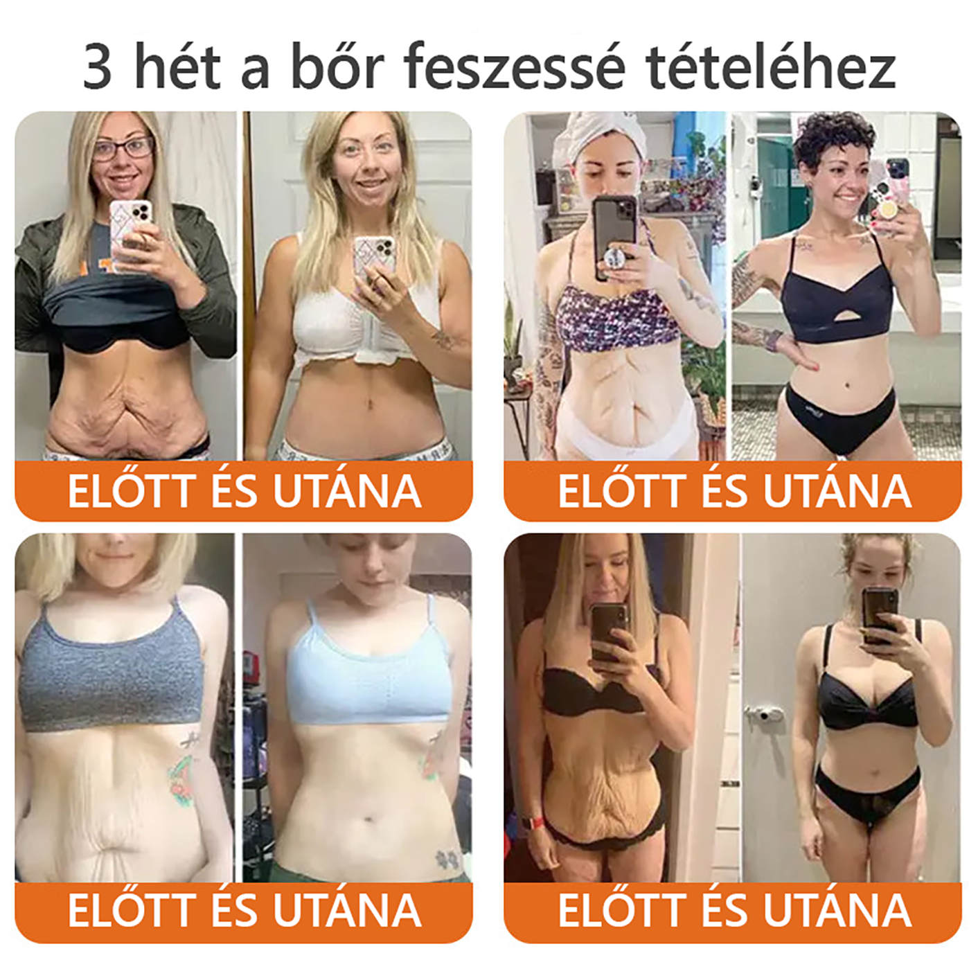 ✨✨ ZödVita® Méhméreg Bőr Helyreállító Krém 🔥 Természetes Öregedésgátló, Feszesíti a Bőrt, Csökkenti a Ráncokat– 50ml