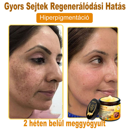 ✨✨ ZödVita® Méhméreg Bőr Helyreállító Krém 🔥 Természetes Öregedésgátló, Feszesíti a Bőrt, Csökkenti a Ráncokat– 50ml