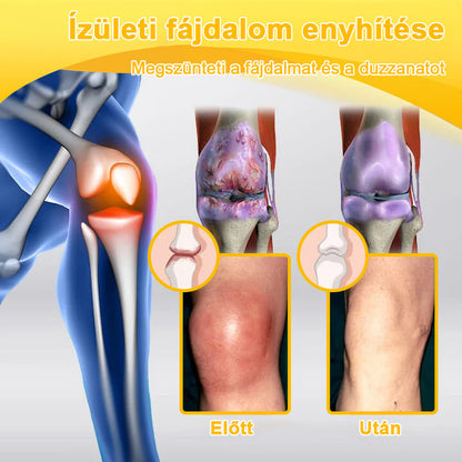 🟢 𝑺𝒕𝒂𝒘𝑽𝒊𝒕𝒂𝒍® Botoxot és Méhmérget Tartalmazó Regeneráló Krém Ízületekre és Csontokra | Ortopédiai problémák és ízületi fájdalmak célzott kezelésére🍀🍀