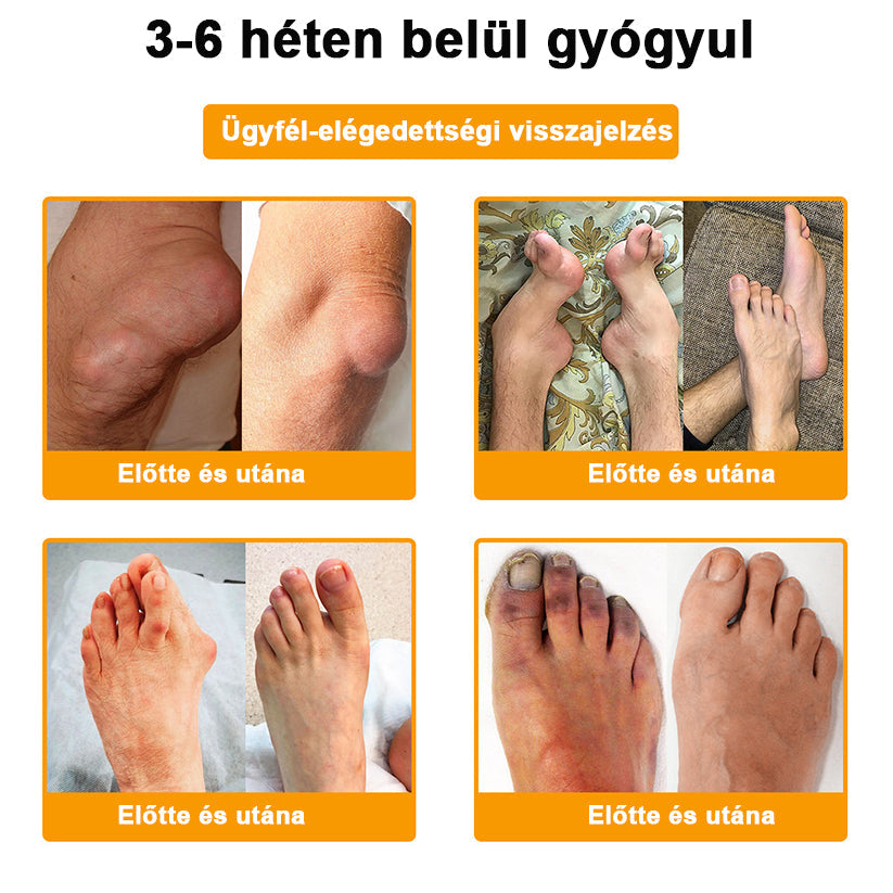 🟢 𝑺𝒕𝒂𝒘𝑽𝒊𝒕𝒂𝒍® Botoxot és Méhmérget Tartalmazó Regeneráló Krém Ízületekre és Csontokra | Ortopédiai problémák és ízületi fájdalmak célzott kezelésére🍀🍀