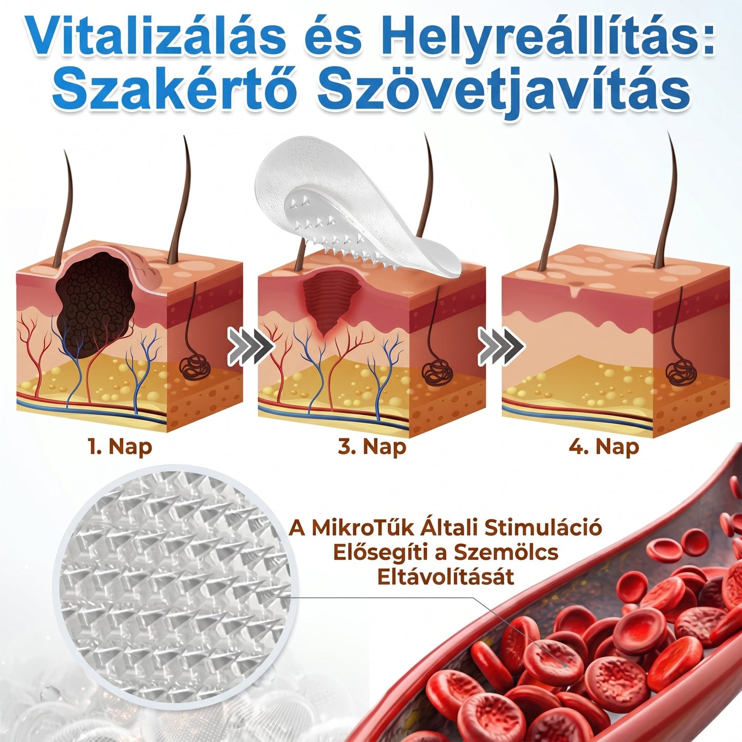✨✨ 2 az 1-ben mikrotűs és hidrokolloid tapasz🍀 | Kiálló anyajegyek, aknék, lapos szemölcsök és bőrnövedékek eltávolítására | Segít csökkenteni a ráncokat, hegeket és bőrhibákat | Láthatatlan tapasz az arcra és testre