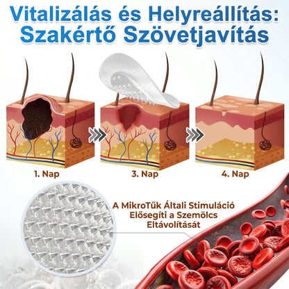 ✨✨ 2 az 1-ben mikrotűs és hidrokolloid tapasz🍀 | Kiálló anyajegyek, aknék, lapos szemölcsök és bőrnövedékek eltávolítására | Segít csökkenteni a ráncokat, hegeket és bőrhibákat | Láthatatlan tapasz az arcra és testre