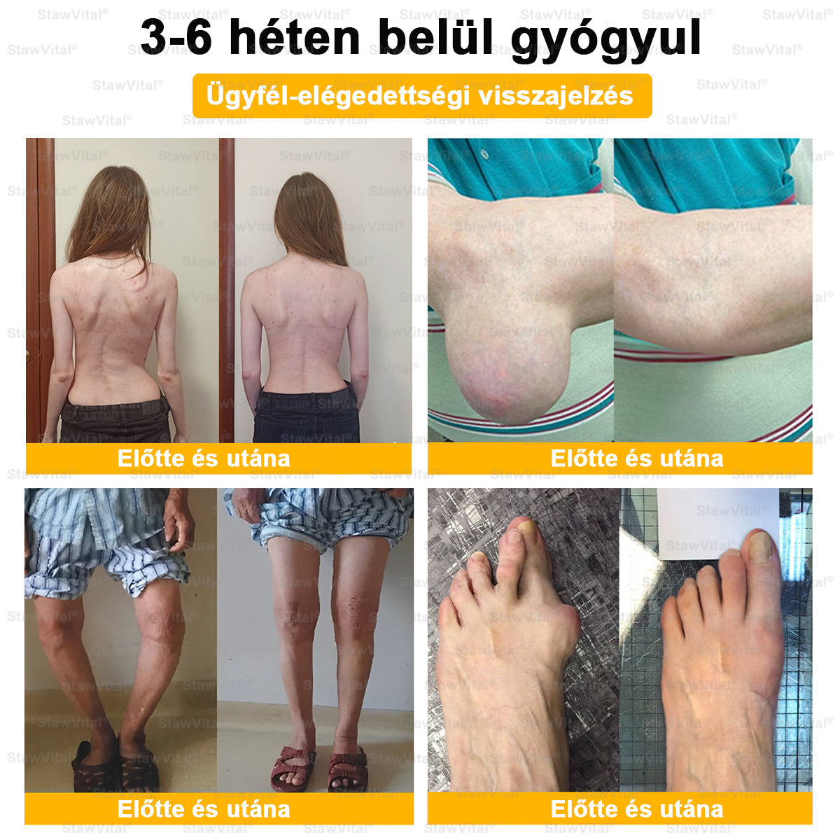 🟢 𝑺𝒕𝒂𝒘𝑽𝒊𝒕𝒂𝒍® Botoxot és Méhmérget Tartalmazó Regeneráló Krém Ízületekre és Csontokra | Ortopédiai problémák és ízületi fájdalmak célzott kezelésére🍀🍀