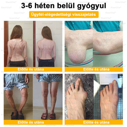 🟢 𝑺𝒕𝒂𝒘𝑽𝒊𝒕𝒂𝒍® Botoxot és Méhmérget Tartalmazó Regeneráló Krém Ízületekre és Csontokra | Ortopédiai problémák és ízületi fájdalmak célzott kezelésére🍀🍀