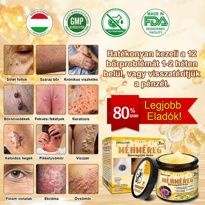 ✨✨FDA által jóváhagyva: 𝐍𝐎𝐑𝐔𝐈𝐎𝐍® 𝐌é𝐡𝐦é𝐫𝐞𝐠 𝐁ő𝐫𝐦𝐞𝐠ú𝐣í𝐭ó 𝐊𝐫é𝐦 — 🔥𝐊𝐨𝐫𝐥á𝐭𝐨𝐳𝐨𝐭𝐭 𝐢𝐝𝐞𝐢𝐠 𝟕𝟎% 𝐤𝐞𝐝𝐯𝐞𝐳𝐦é𝐧𝐲🔥