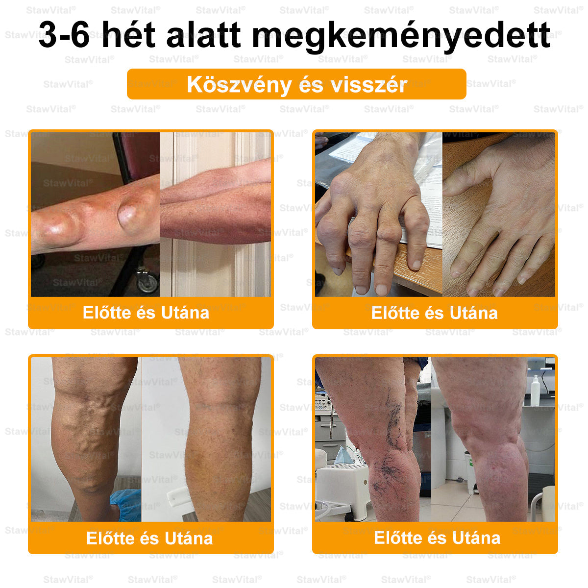 🟢 𝑺𝒕𝒂𝒘𝑽𝒊𝒕𝒂𝒍® Botoxot és Méhmérget Tartalmazó Regeneráló Krém Ízületekre és Csontokra | Ortopédiai problémák és ízületi fájdalmak célzott kezelésére🍀🍀
