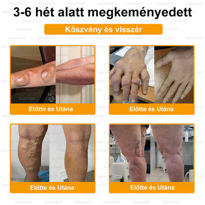 🟢 𝑺𝒕𝒂𝒘𝑽𝒊𝒕𝒂𝒍® Botoxot és Méhmérget Tartalmazó Regeneráló Krém Ízületekre és Csontokra | Ortopédiai problémák és ízületi fájdalmak célzott kezelésére🍀🍀