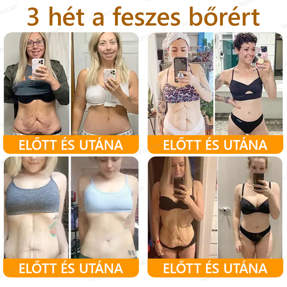 ✨✨FDA által jóváhagyva: 𝐍𝐎𝐑𝐔𝐈𝐎𝐍® 𝐌é𝐡𝐦é𝐫𝐞𝐠 𝐁ő𝐫𝐦𝐞𝐠ú𝐣í𝐭ó 𝐊𝐫é𝐦 — 🔥𝐊𝐨𝐫𝐥á𝐭𝐨𝐳𝐨𝐭𝐭 𝐢𝐝𝐞𝐢𝐠 𝟕𝟎% 𝐤𝐞𝐝𝐯𝐞𝐳𝐦é𝐧𝐲🔥