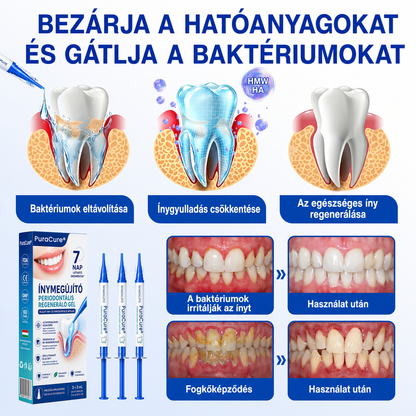 🇭🇺👨‍⚕️👨‍⚕️✅🦷 PuraCure® ÍNYMEGÚJÍTÓ – Parodontális helyreállító gél🧂