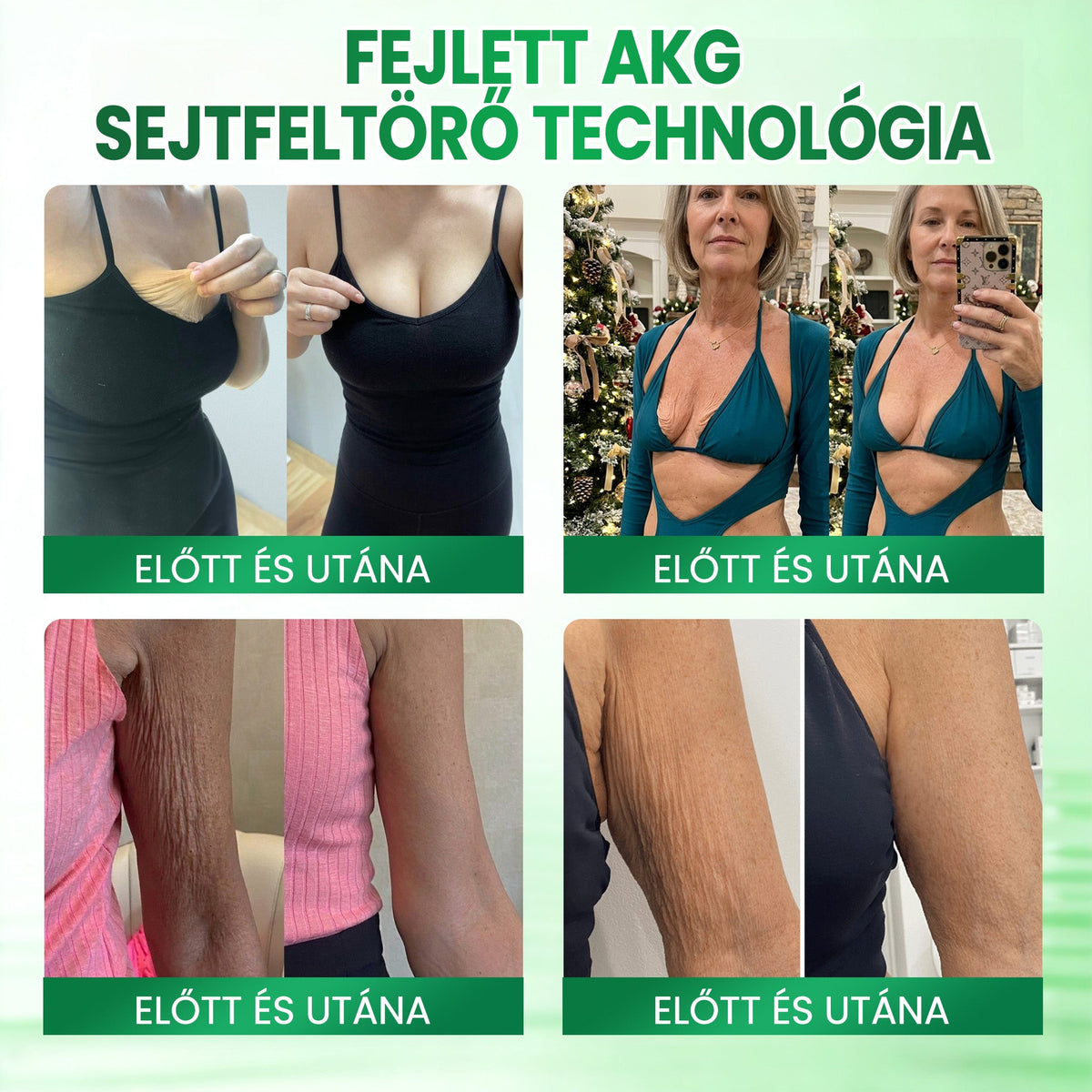🔥🔥🔥🔥Medistart® AKG BŐRFESZESÍTŐ & ÖREGEDÉS ELLENI ÁPOLÁS