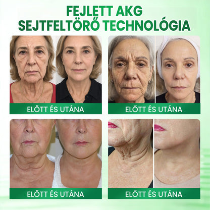 🔥🔥🔥🔥Medistart® AKG BŐRFESZESÍTŐ & ÖREGEDÉS ELLENI ÁPOLÁS