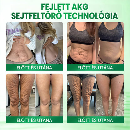 🔥🔥🔥🔥Medistart® AKG BŐRFESZESÍTŐ & ÖREGEDÉS ELLENI ÁPOLÁS