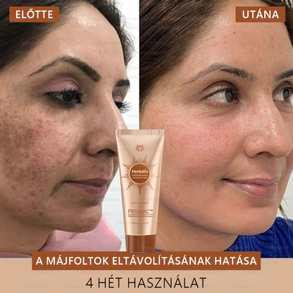 👩‍⚕️👩‍⚕️𝐅𝐑𝐈𝐒𝐒𝐀𝐑𝐂™ Fehérítő És Folteltávolító Arcmaszk | Természetes összetevők tartósan eltüntetik a foltokat, szeplőket és napfoltokat🔥