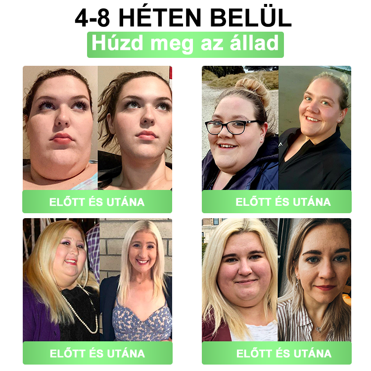 🎀BSWELL® Nano mikrotűs karcsúsító tapasz (Csak naponta egyszer, látható változások 28 nap alatt) ✅ Elhízás, szív- és érrendszeri egészség, cukorbetegség, alvási apnoe, bélrendszer egészsége, ízületi problémák és még sok más