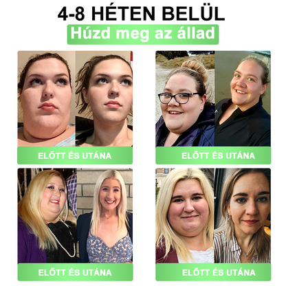 🎀BSWELL® Nano mikrotűs karcsúsító tapasz (Csak naponta egyszer, látható változások 28 nap alatt) ✅ Elhízás, szív- és érrendszeri egészség, cukorbetegség, alvási apnoe, bélrendszer egészsége, ízületi problémák és még sok más