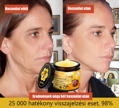 ✨✨ ZödVita® Méhméreg Bőr Helyreállító Krém 🔥 Természetes Öregedésgátló, Feszesíti a Bőrt, Csökkenti a Ráncokat– 50ml