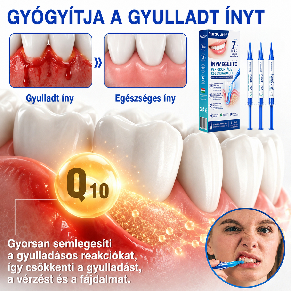 🇭🇺👨‍⚕️👨‍⚕️✅🦷 PuraCure® ÍNYMEGÚJÍTÓ – Parodontális helyreállító gél🧂