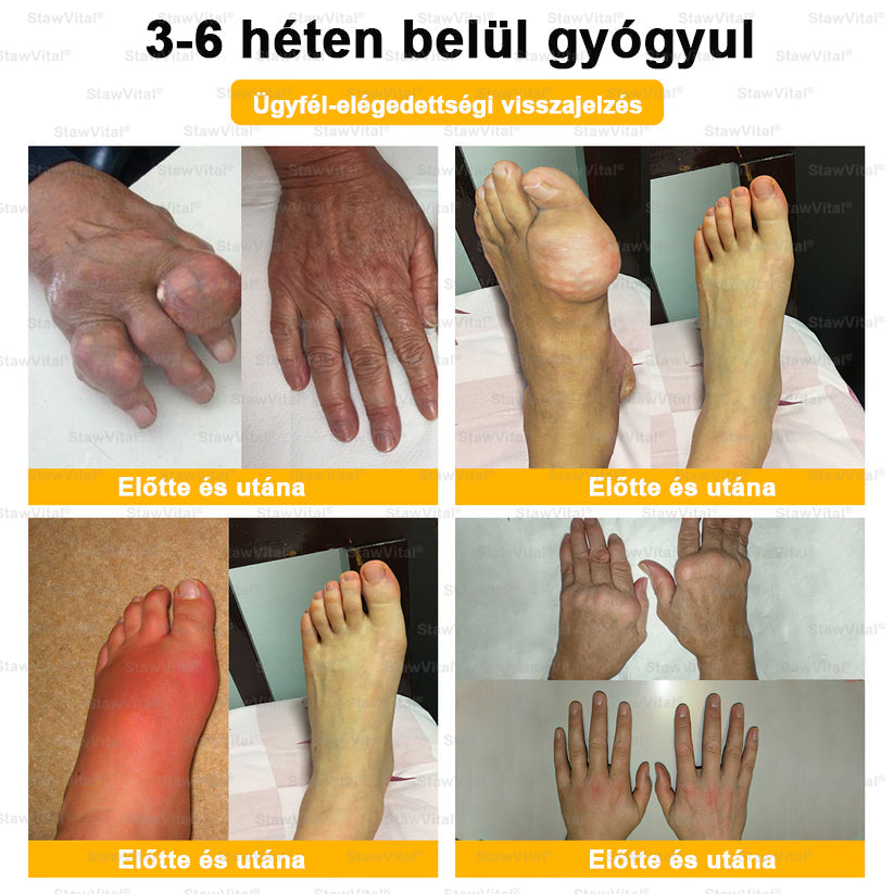 🟢 𝑺𝒕𝒂𝒘𝑽𝒊𝒕𝒂𝒍® Botoxot és Méhmérget Tartalmazó Regeneráló Krém Ízületekre és Csontokra | Ortopédiai problémák és ízületi fájdalmak célzott kezelésére🍀🍀