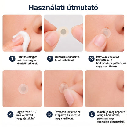 ✨✨ 2 az 1-ben mikrotűs és hidrokolloid tapasz🍀 | Kiálló anyajegyek, aknék, lapos szemölcsök és bőrnövedékek eltávolítására | Segít csökkenteni a ráncokat, hegeket és bőrhibákat | Láthatatlan tapasz az arcra és testre