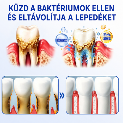 🇭🇺👨‍⚕️👨‍⚕️✅🦷 PuraCure® ÍNYMEGÚJÍTÓ – Parodontális helyreállító gél🧂