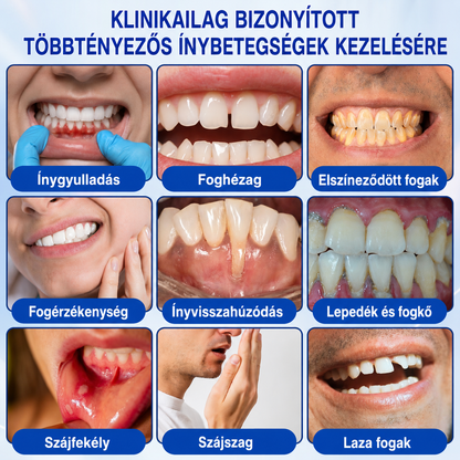 🇭🇺👨‍⚕️👨‍⚕️✅🦷 PuraCure® ÍNYMEGÚJÍTÓ – Parodontális helyreállító gél🧂