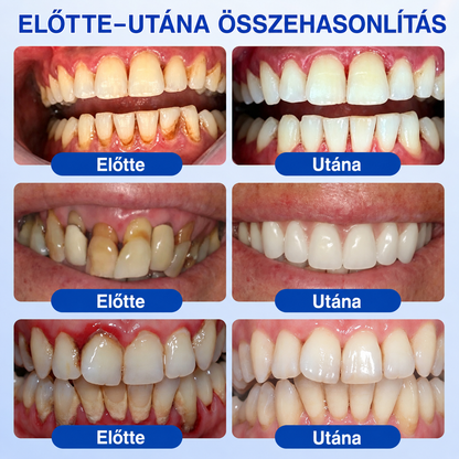 🇭🇺👨‍⚕️👨‍⚕️✅🦷 PuraCure® ÍNYMEGÚJÍTÓ – Parodontális helyreállító gél🧂