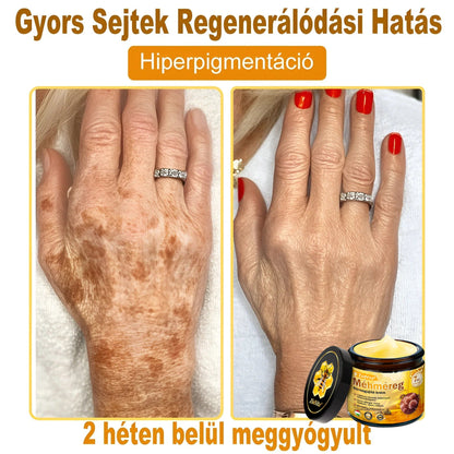 🔥 ZödVita® Méhméreg Bőr Helyreállító Krém 🔥 Magyar fejlesztés, magyarországi gyártás és szállítás