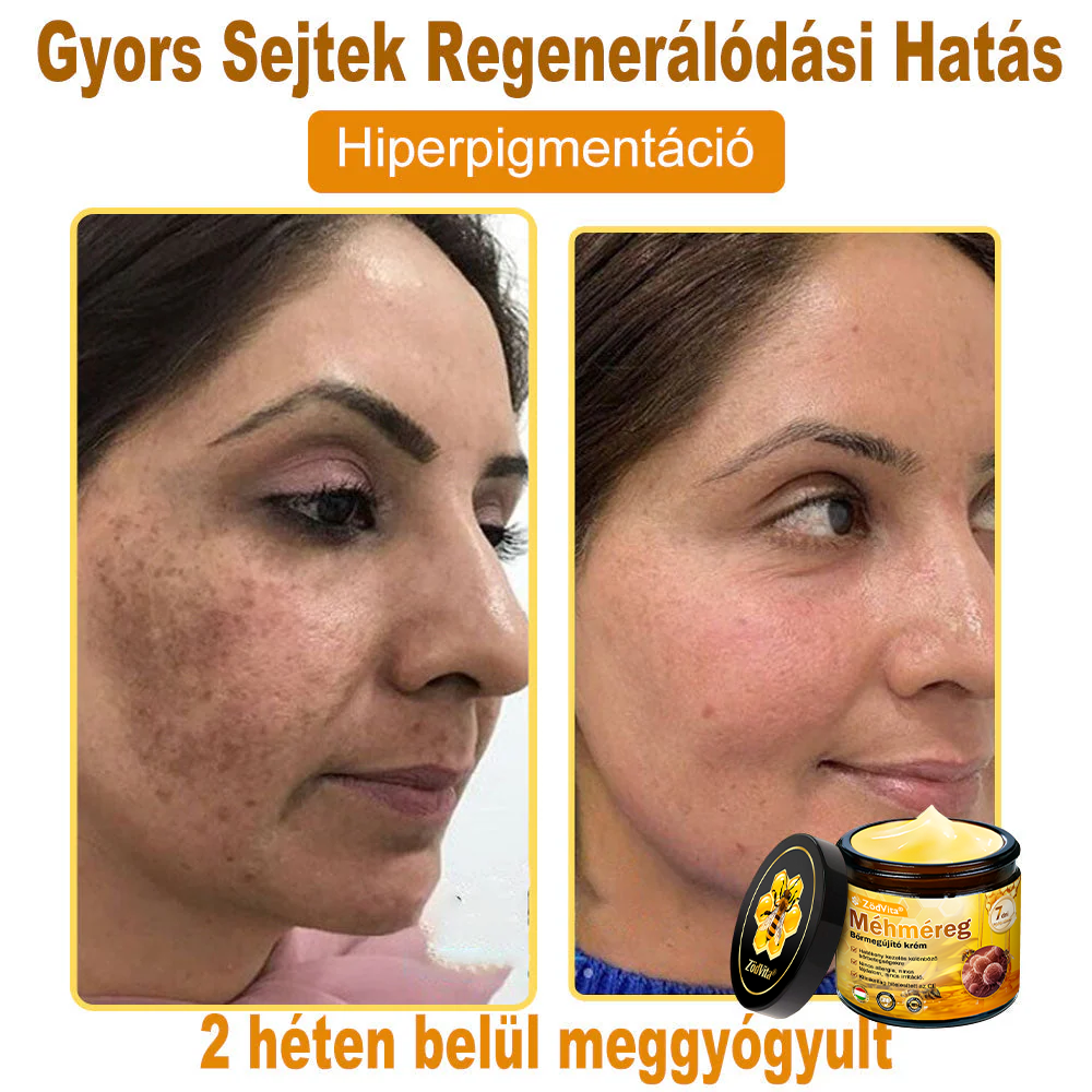 🔥 ZödVita® Méhméreg Bőr Helyreállító Krém 🔥 Magyar fejlesztés, magyarországi gyártás és szállítás